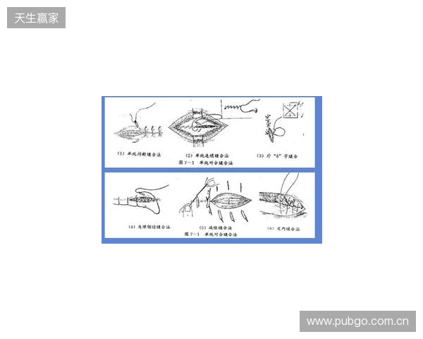 广州豹官方：杨浩眉弓伤口缝合30余针，预计5-7天后拆线